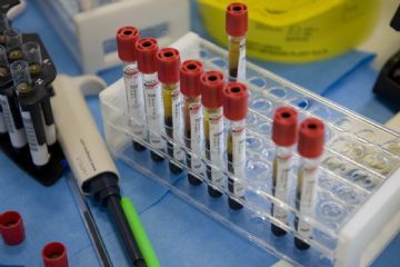 Servizio Prelievi del Sangue  - Chiusura Estiva